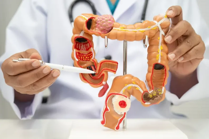 "فوائد الأسبرين للوقاية من السرطان.. ثورة طبية في مواجهة الأورام الخبيثة والاضطرابات الوراثية
