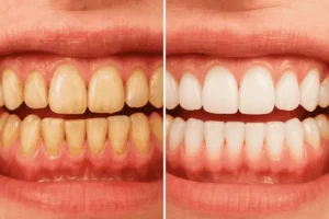 طرق حماية الأسنان وتوصيات أطباء الأسنان لمنع التصبغات والحفاظ على بياضها الطبيعي طرق حماية الأسنان وتوصيات أطباء الأسنان لمنع التصبغات والحفاظ على بياضها الطبيعي