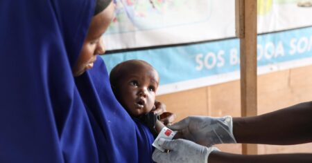 أزمة سوء التغذية في الصومال